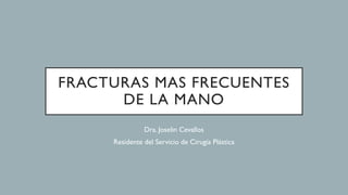 FRACTURAS MAS FRECUENTES
DE LA MANO
Dra. Joselin Cevallos
Residente del Servicio de Cirugía Plástica
 