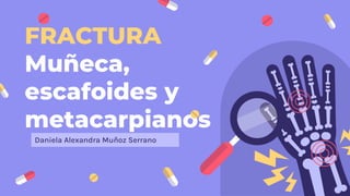 FRACTURA
Muñeca,
escafoides y
metacarpianos
Daniela Alexandra Muñoz Serrano
 