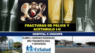 FRACTURAS DE PELVIS Y
ACETABULO I-II
ELMER J. NARVAEZ RODRIGUEZ
MR3 TRAUMATOLOGIA
Y ORTOPEDIA
 