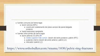 https://www.orthobullets.com/trauma/1030/pelvic-ring-fractures
 