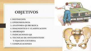 OBJETIVOS
1. DEFINICION
2. EPIDEMIOLOGIA
3. ANATOMIA QUIRURGICA
4. DIAGNOSTICO Y CLASIFICACION
5. ABORDAJES
7. INDICACIONES QX
6. TECNICAS DE OSTEOSINTESIS
Y FIJACION EXTERNA
7. COMPLICACIONES
 