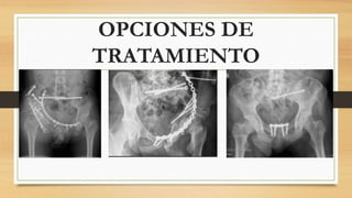 OPCIONES DE
TRATAMIENTO
 