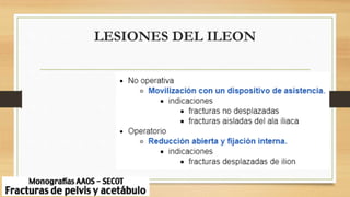 LESIONES DEL ILEON
 