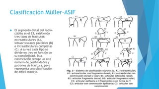 FX de radio distal .pptx