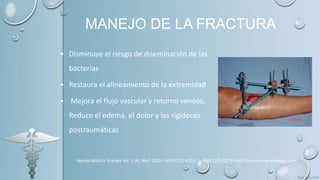 MANEJO DE LA FRACTURA
• Disminuye el riesgo de diseminación de las
bacterias
• Restaura el alineamiento de la extremidad
• Mejora el flujo vascular y retorno venoso,
Reduce el edema, el dolor y las rigideces
postraumáticas
Revista Médica Sinergia Vol. 5 (4), Abril 2020 - ISSN:2215-4523 / e-ISSN:2215-5279 http://revistamedicasinergia.com
 