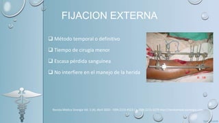 FIJACION EXTERNA
 Método temporal o definitivo
 Tiempo de cirugía menor
 Escasa pérdida sanguínea
 No interfiere en el manejo de la herida
Revista Médica Sinergia Vol. 5 (4), Abril 2020 - ISSN:2215-4523 / e-ISSN:2215-5279 http://revistamedicasinergia.com
 
