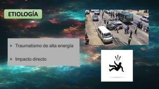ETIOLOGÍA
 