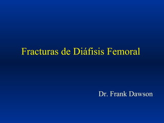 Fracturas de Diáfisis Femoral  Dr. Frank Dawson 