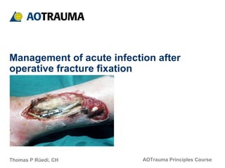 AOTrauma Principles Course
Management of acute infection after
operative fracture fixation
Thomas P Rüedi, CH
 