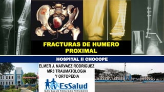 FRACTURAS DE HUMERO
PROXIMAL
ELMER J. NARVAEZ RODRIGUEZ
MR3 TRAUMATOLOGIA
Y ORTOPEDIA
 
