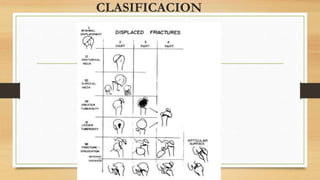 CLASIFICACION
 