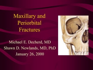 Maxillary and
Periorbital
Fractures
Michael E. Decherd, MD
Shawn D. Newlands, MD, PhD
January 26, 2000
 