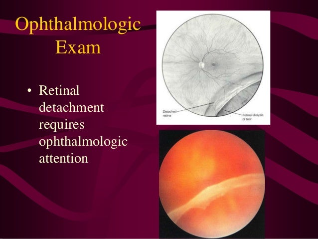 Top 10 Best Eye Exam In Reno Nv Last Updated April 2021 Yelp Top 10 Best Eye Exam In Reno Nv Last Updated April 2021 Yelp