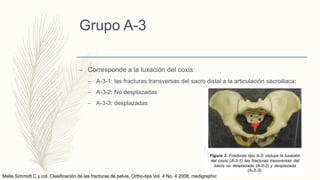 Grupo A-3
– Corresponde a la luxación del coxis:
– A-3-1: las fracturas transversas del sacro distal a la articulación sacroiliaca:
– A-3-2: No desplazadas
– A-3-3: desplazadas
Mella Schmidt C y col. Clasificación de las fracturas de pelvis. Ortho-tips Vol. 4 No. 4 2008. medigraphic
 
