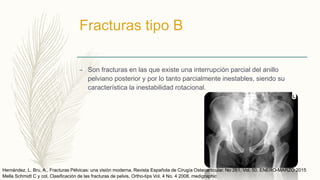 Fracturas tipo B
– Son fracturas en las que existe una interrupción parcial del anillo
pelviano posterior y por lo tanto parcialmente inestables, siendo su
característica la inestabilidad rotacional.
Mella Schmidt C y col. Clasificación de las fracturas de pelvis. Ortho-tips Vol. 4 No. 4 2008. medigraphic
Hernández, L. Bru, A., Fracturas Pélvicas: una visión moderna. Revista Española de Cirugía Osteoarticular. No 261. Vol. 50. ENERO-MARZO 2015
 