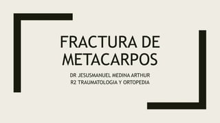 FRACTURA DE
METACARPOS
DR JESUSMANUEL MEDINA ARTHUR
R2 TRAUMATOLOGIA Y ORTOPEDIA
 