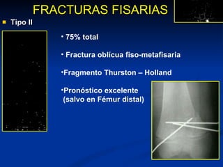 Tipo II FRACTURAS FISARIAS 75% total Fractura oblícua fiso-metafisaria Fragmento Thurston – Holland Pronóstico excelente  (salvo en Fémur distal) 