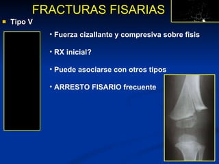 Tipo V FRACTURAS FISARIAS Fuerza cizallante y compresiva sobre fisis RX inicial? Puede asociarse con otros tipos ARRESTO FISARIO frecuente 