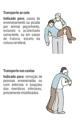 Transporteaocolo
Indicado para: casos de
envenenamento ou picada
por animal peçonhento,
estando o acidentado
consciente, ou em casos
de fratura, exceto da
colunavertebral.
Transportenascostas
Indicado para: remoção de
pessoas envenenadas ou
com entorses e luxações
dos membros inferiores,
previamenteimobilizados.
 