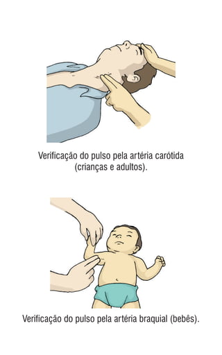Verificação do pulso pela artéria carótida
(crianças e adultos).
Verificação do pulso pela artéria braquial (bebês).
 