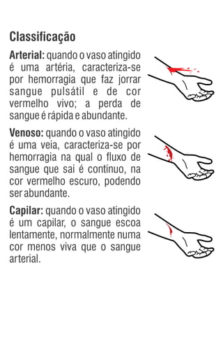 Classificação
Arterial: quando o vaso atingido
é uma artéria, caracteriza-se
por hemorragia que faz jorrar
sangue pulsátil e de cor
vermelho vivo; a perda de
sangueérápidaeabundante.
Venoso: quando o vaso atingido
é uma veia, caracteriza-se por
hemorragia na qual o fluxo de
sangue que sai é contínuo, na
cor vermelho escuro, podendo
serabundante.
Capilar: quando o vaso atingido
é um capilar, o sangue escoa
lentamente, normalmente numa
cor menos viva que o sangue
arterial.
 