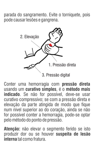 2. Elevação
3. Pressão digital
1. Pressão direta
Conter uma hemorragia com pressão direta
usando um curativo simples, é o método mais
indicado. Se não for possível, deve-se usar
curativo compressivo; se com a pressão direta e
elevação da parte atingida de modo que fique
num nível superior ao do coração, ainda se não
for possível conter a hemorragia, pode-se optar
pelométododopontodepressão.
parada do sangramento. Evite o torniquete, pois
podecausarlesõesegangrena.
Atenção: não elevar o segmento ferido se isto
produzir dor ou se houver suspeita de lesão
internatalcomofratura.
 