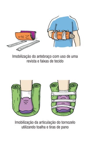 Imobilização do antebraço com uso de uma
revista e faixas de tecido
Imobilização da articulação do tornozelo
utilizando toalha e tiras de pano
 