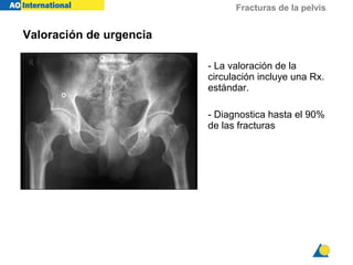 Fracturas de la pelvis
- La valoración de la
circulación incluye una Rx.
estándar.
- Diagnostica hasta el 90%
de las fracturas
Valoración de urgencia
 