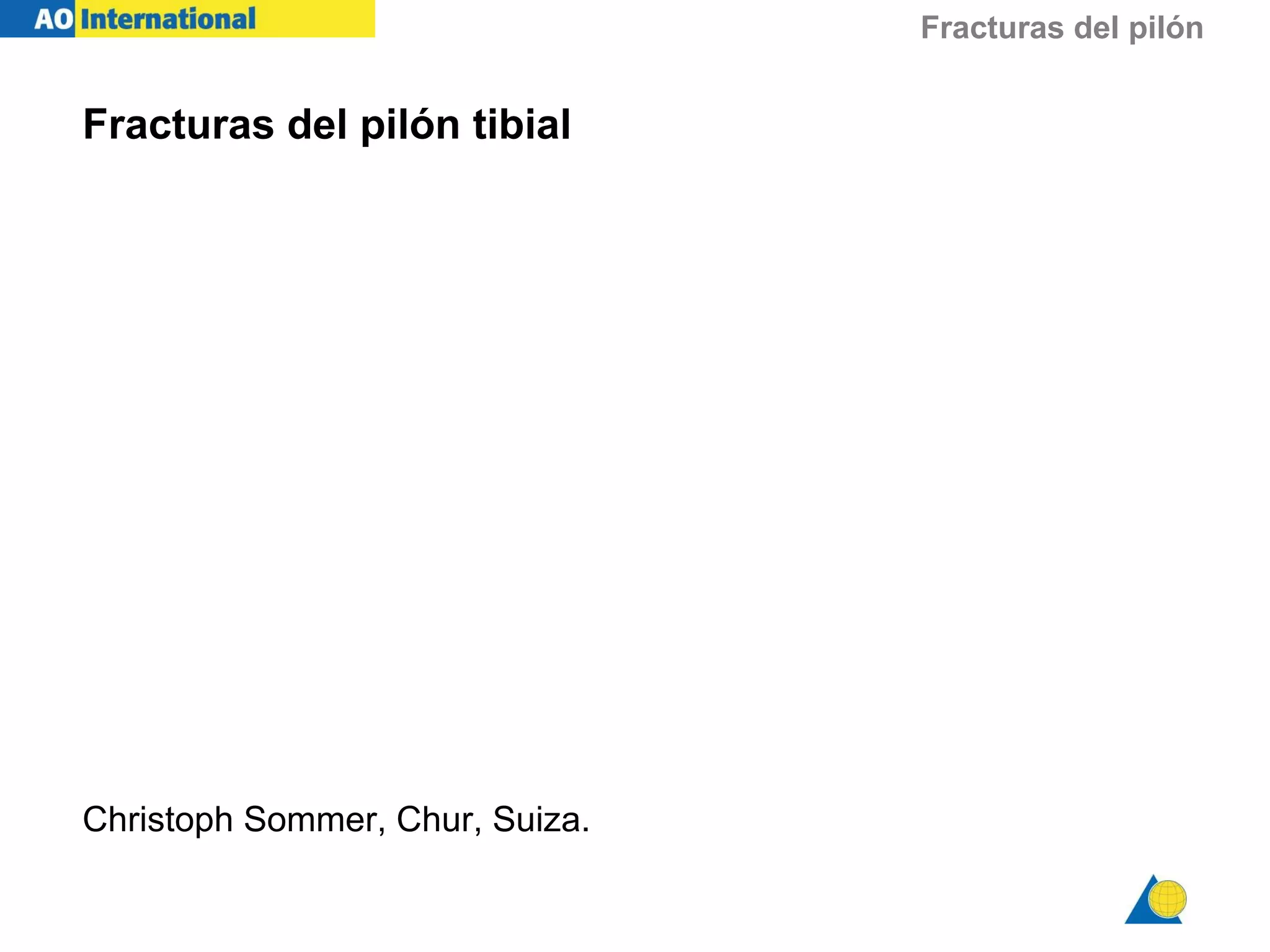 Fx pilon tibial | PPT