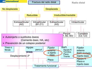 Radio distal
estable inestable
desplazamiento 2º
Desplazamiento 2º
Reductible Irreductible/inestable
Extraaarticular
(A2)
Intraarticular
(B1,C1)
Extraarticular
(A3)
Intraarticular
Reducción cerrada
Parcial
(B1, B2, B3)
Completa
(C2, C3)
Yeso o
férula
RAFI
Agujas K
Tornillos
Placa
Tirante
Tratamiento funcional
No desplazada Desplazada
Fractura del radio distal
Agujas
percut
áneas
Fijador
externo
± injerto
óseo
Placa
Fijador
externo
RAFI limitada
Injerto óseo
Agujas K
Placa e
Injerto óseo
⮚ Autoinjerto o sustitutos óseos
(Cemento óseo, HA, etc)
⮚ Prevención de un colapso posterior
 