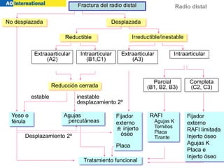 Radio distal
estable inestable
desplazamiento 2º
Desplazamiento 2º
Reductible Irreductible/inestable
Extraaarticular
(A2)
Intraarticular
(B1,C1)
Extraarticular
(A3)
Intraarticular
Reducción cerrada
Parcial
(B1, B2, B3)
Completa
(C2, C3)
Yeso o
férula
RAFI
Agujas K
Tornillos
Placa
Tirante
Tratamiento funcional
No desplazada Desplazada
Fractura del radio distal
Agujas
percutáneas
Fijador
externo
± injerto
óseo
Placa
Fijador
externo
RAFI limitada
Injerto óseo
Agujas K
Placa e
Injerto óseo
 
