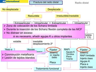 Radio distal
estable inestable
desplazamiento 2º
Desplazamiento 2º
Reductible Irreductible/inestable
Extraaarticular
(A2)
Intraarticular
(B1,C1)
Extraarticular
(A3)
Intraarticular
Reducción cerrada
Parcial
(B1, B2, B3)
Completa
(C2, C3)
Yeso o
férula
RAFI
Agujas K
Tornillos
Placa
Tirante
Tratamiento funcional
No desplazada Desplazada
Fractura del radio distal
Agujas
percutáneas
Fijador
externo
± injerto
óseo
Placa
Fijador
externo
RAFI limitada
Injerto óseo
Agujas K
Placa e
Injerto óseo
 Zona de colocación de los Schanz limitada
 Durante la inserción de los Schanz flexión completa de las MCF
 No distraer en exceso
si es necesario, añadir agujas K u otros implantes
 Conminución metafisaria
 Lesión de tejidos blandos
 