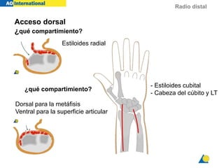 Radio distal
Acceso dorsal
¿qué compartimiento?
¿qué compartimiento?
Estiloides radial
Dorsal para la metáfisis
Ventral para la superficie articular
- Estiloides cubital
- Cabeza del cúbito y LT
 