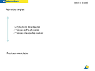 Radio distal
Fracturas simples
- Mínimamente desplazadas
- Fracturas extra-articulares
- Fracturas impactadas estables
Fracturas complejas
 