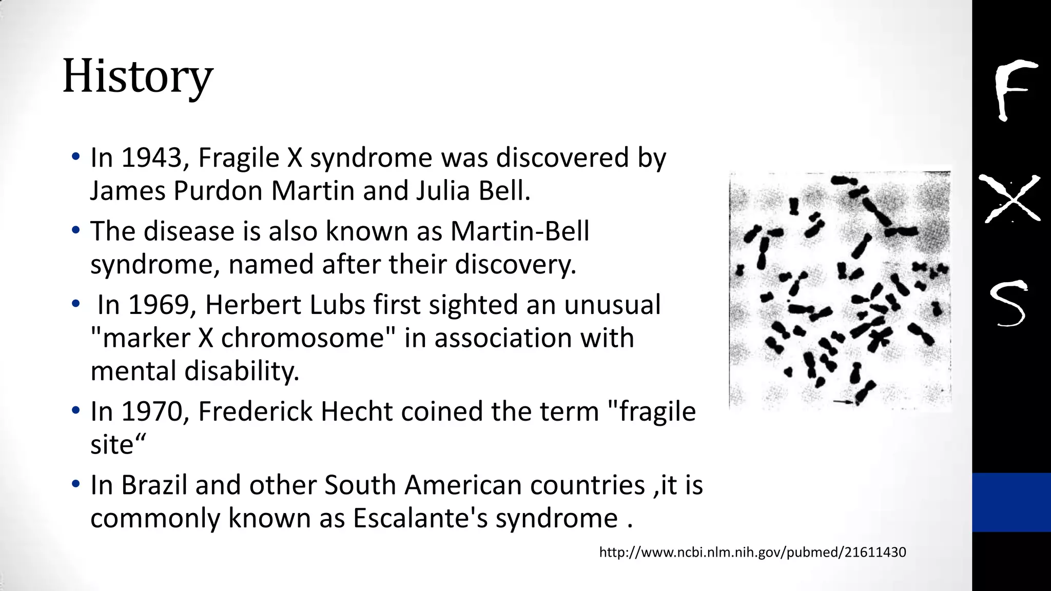 History
• In 1943, Fragile X syndrome was discovered by
James Purdon Martin and Julia Bell.
• The disease is also known as Martin-Bell
syndrome, named after their discovery.
• In 1969, Herbert Lubs first sighted an unusual
"marker X chromosome" in association with
mental disability.
• In 1970, Frederick Hecht coined the term "fragile
site“
• In Brazil and other South American countries ,it is
commonly known as Escalante's syndrome .
http://www.ncbi.nlm.nih.gov/pubmed/21611430
 