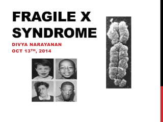 FRAGILE X 
SYNDROME 
DIVYA NARAYANAN 
OCT 13TH, 2014 
 