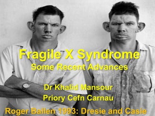 Fragile X Syndrome
Some Recent Advances
Dr Khalid Mansour
Priory Cefn Carnau
Roger Ballen 1993: Dresie and Casie
 
