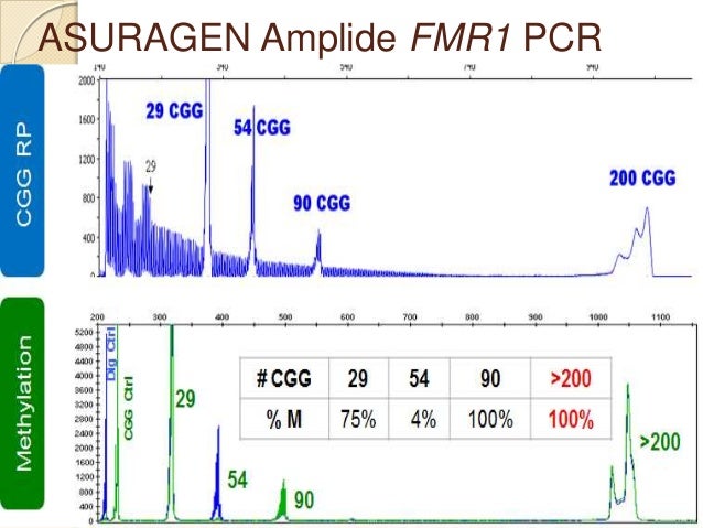blood x test results fragile Syndrome X Fragile