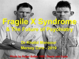 Fragile X Syndrome
& The Future of Psychiatry
Dr Khalid Mansour
Mersey Care - 2019
Photo by Roger Ballen 1993: Dresie and Casie
 