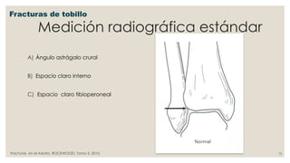 Angulo Tobillo FX TOBILLO LEÑERO.pptxjljkjkljkjkjkjkjkjk | PPTX