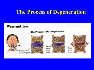The Process of Degeneration
 