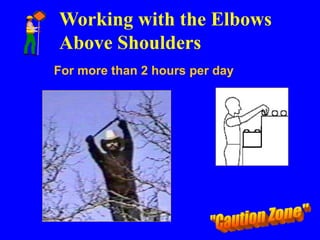 Working with the Elbows
Above Shoulders
For more than 2 hours per day
 