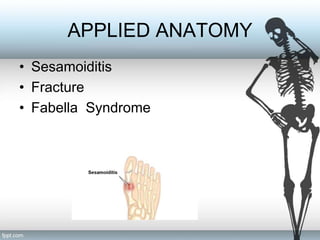 Sesamoid Bones The Ultimate Matching Game - 0p6le47