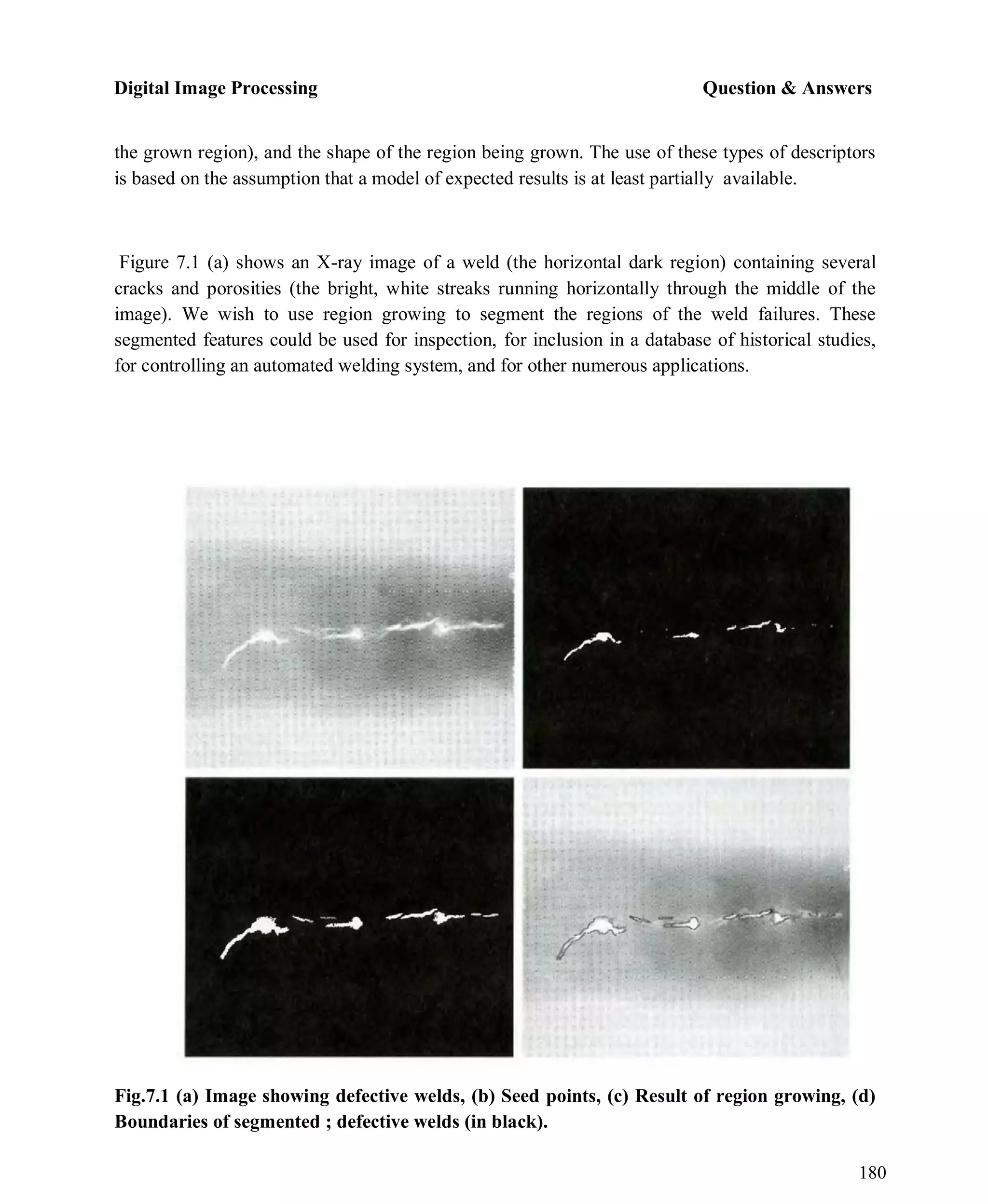 Digital Image Processing Question & Answers
180
the grown region), and the shape of the region being grown. The use of these types of descriptors
is based on the assumption that a model of expected results is at least partially available.
Figure 7.1 (a) shows an X-ray image of a weld (the horizontal dark region) containing several
cracks and porosities (the bright, white streaks running horizontally through the middle of the
image). We wish to use region growing to segment the regions of the weld failures. These
segmented features could be used for inspection, for inclusion in a database of historical studies,
for controlling an automated welding system, and for other numerous applications.
Fig.7.1 (a) Image showing defective welds, (b) Seed points, (c) Result of region growing, (d)
Boundaries of segmented ; defective welds (in black).
 