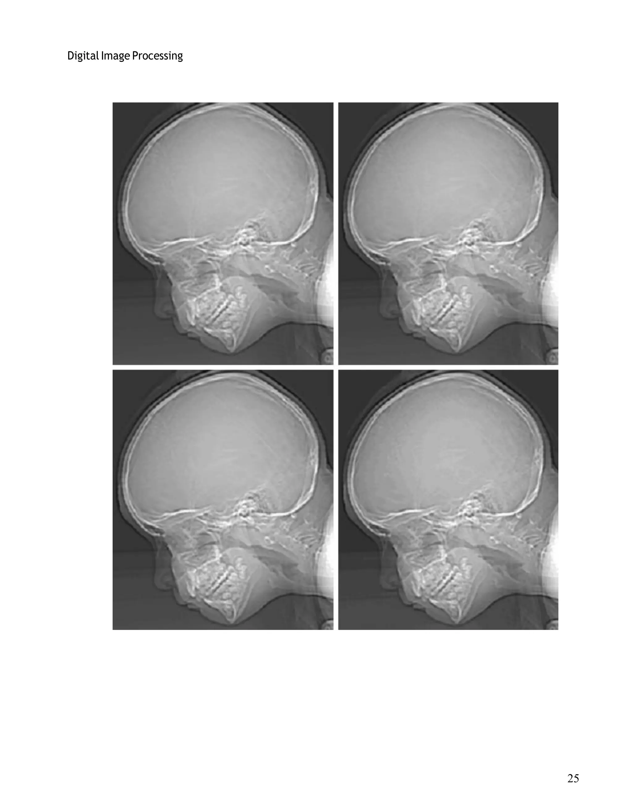 Digital Image Processing
25
 