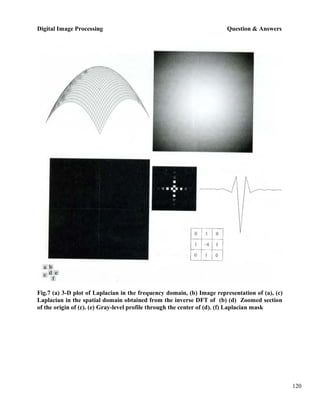Digital Image Processing Question & Answers
120
Fig.7 (a) 3-D plot of Laplacian in the frequency domain, (b) Image representation of (a), (c)
Laplacian in the spatial domain obtained from the inverse DFT of (b) (d) Zoomed section
of the origin of (c). (e) Gray-level profile through the center of (d). (f) Laplacian mask
 