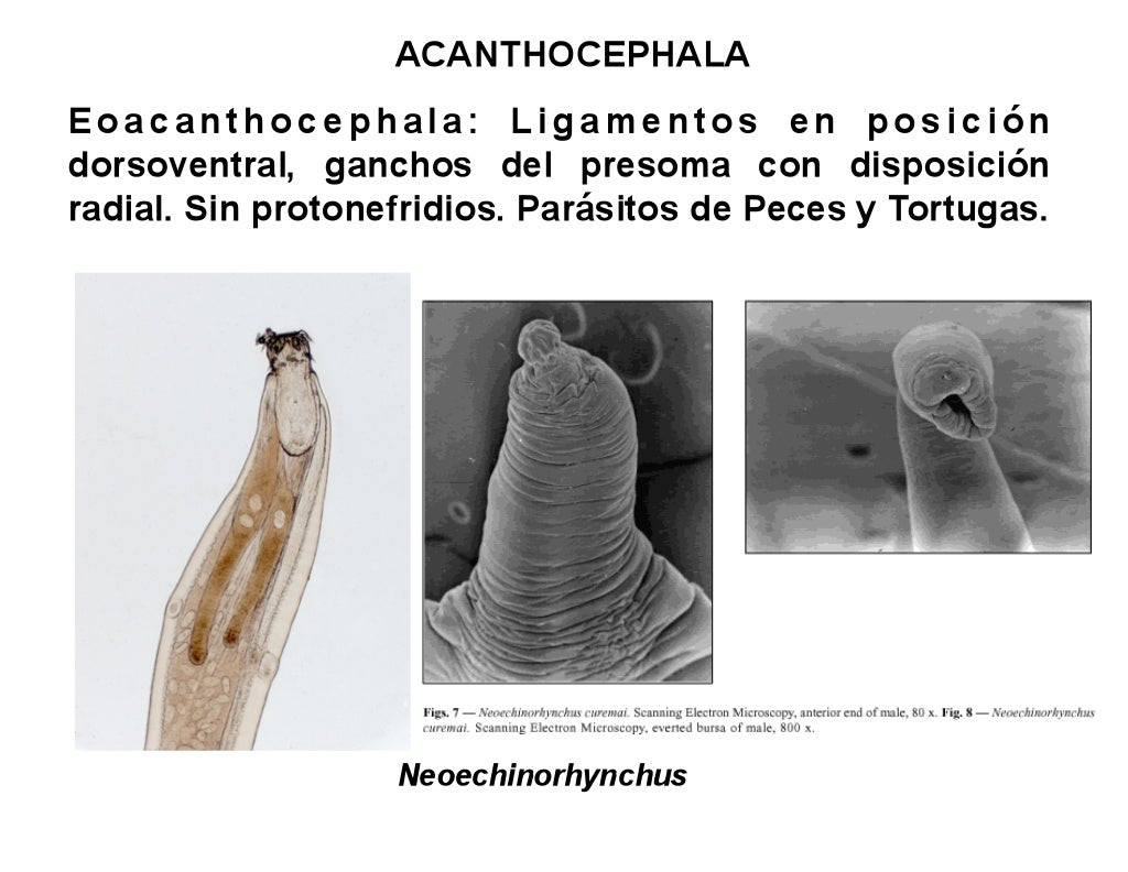 acanthocephala diversity