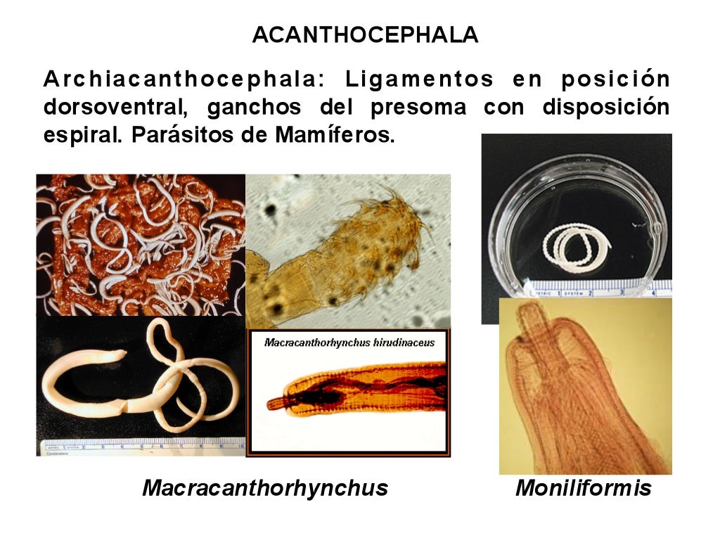 acanthocephala diversity
