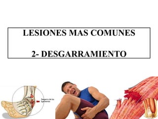 LESIONES MAS COMUNES
2- DESGARRAMIENTO
 