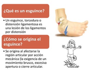 ¿Qué es un esguince?
• Un esguince, torcedura o
distensión ligamentosa es
una lesión de los ligamentos
por distensión
¿Cómo se origina el
esguince?
• Se origina al afectarse la
región articular por acción
mecánica (la exigencia de un
movimiento brusco, excesiva
apertura o cierre articular.
 
